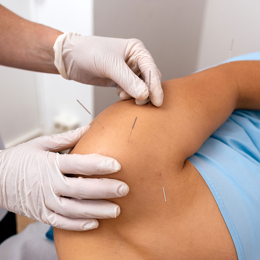 Frozen Shoulder: What It Is, Why It Happens, and How OT Can Help